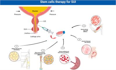 Frontiers Advances in the molecular pathogenesis and cell therapy of